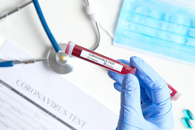 Coronavirus Vaccine Testing